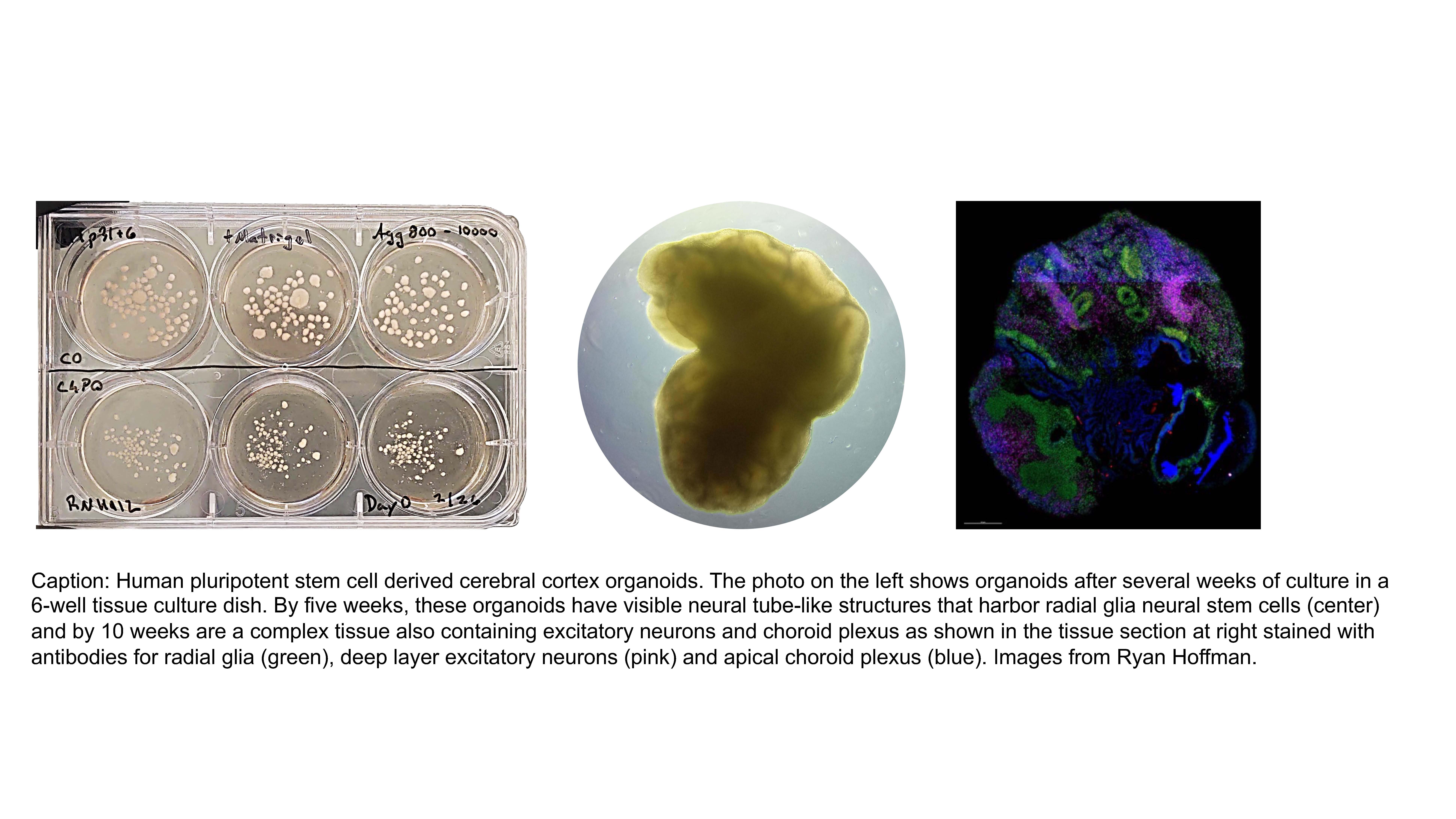 Cerbral cortex organoid overview