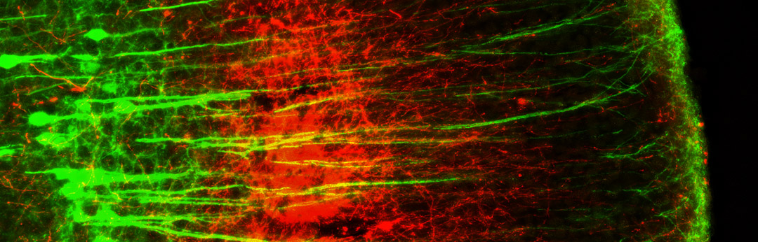 The Zuo lab focuses its research on synapse plasticity and its role in learning and memory